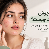 علت-جوش-صورت-چیست